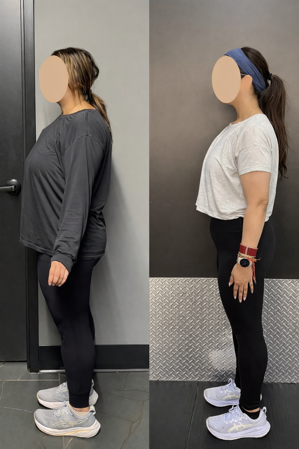 Anj — before and after transformation